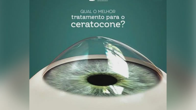 Qual O Melhor Tratamento Para Ceratocone Em Curitiba Oftalmologia