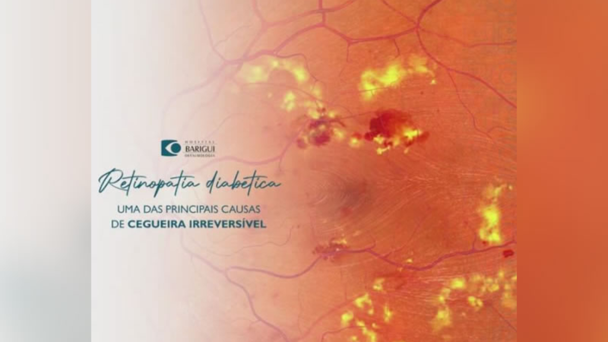 retinopatia diabética em curitiba tratamento cirurgico avançado