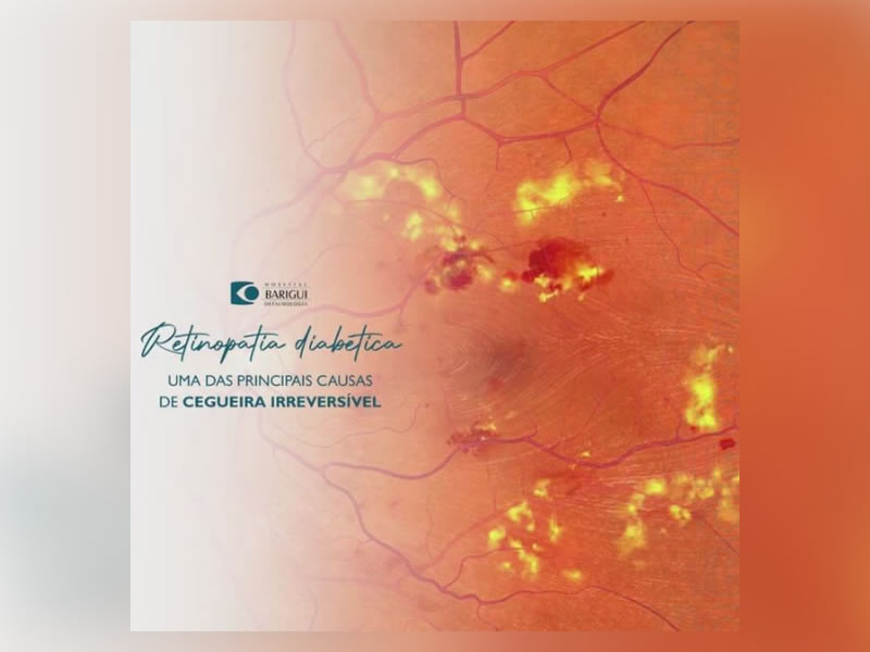 retinopatia diabética em curitiba tratamento cirurgico avançado