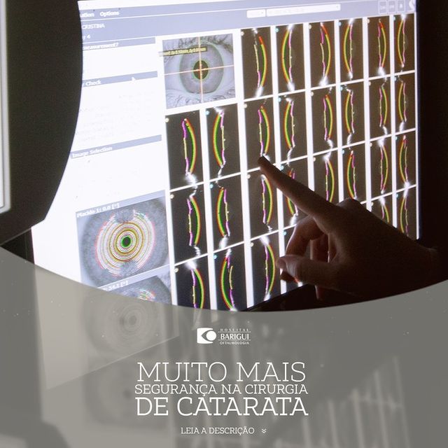 Cirurgia de Catarata em Curitiba - Exames de diagnóstico